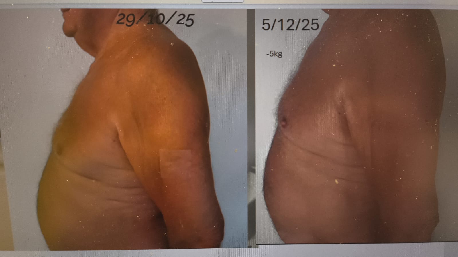Avant / après — femme, perte de 5 kg et 9 cm de tour de nombril en 3 mois avec Feel Great