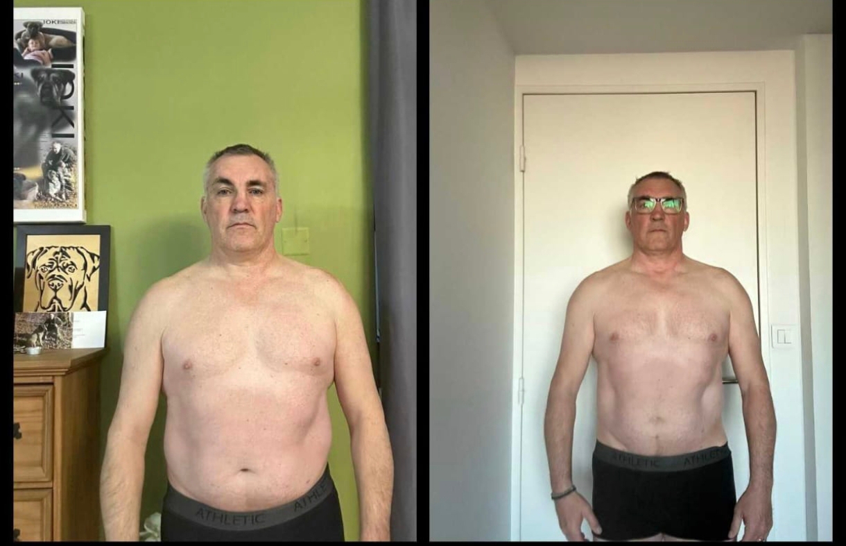 Avant / après — homme, transformation de la silhouette avec Feel Great